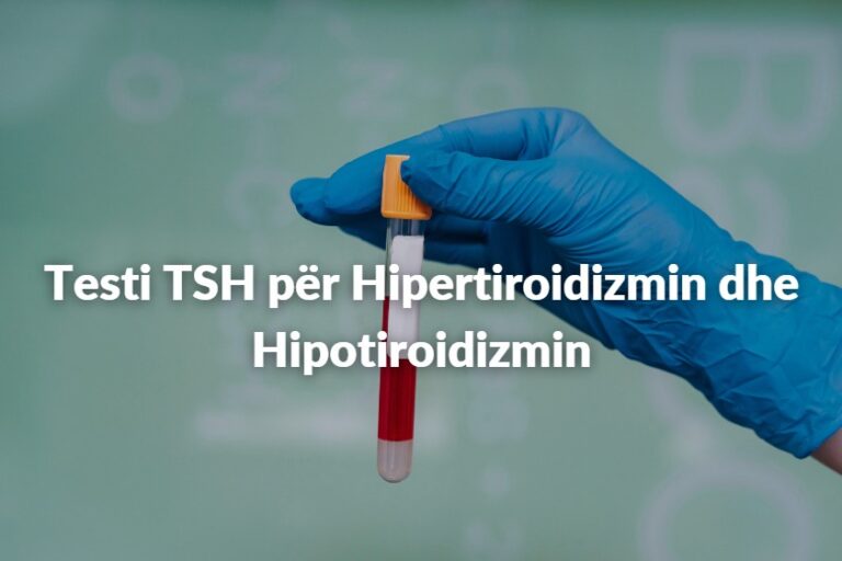 Çfarë është testi TSH dhe çfarë tregon për tiroiden?