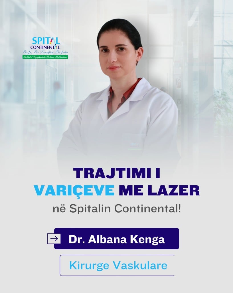 Trajtimi i variceve me lazer